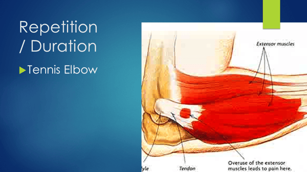 Repetition - Tennis Elbow